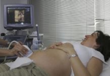 ultrazvuk trudnica pregled ginekolog