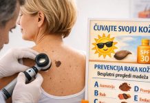 Besplatni pregledi kože 24. travnja u Domu zdravlja Čakovec! pregled kože Čakovec